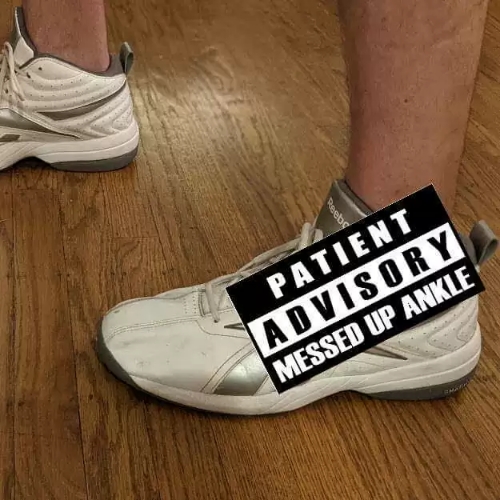 blog-messed-up-ankle